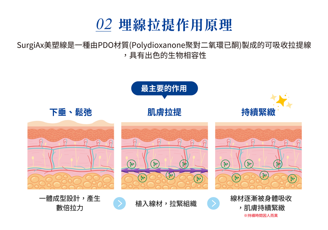 第四代拉提線 美塑線 圖片 3