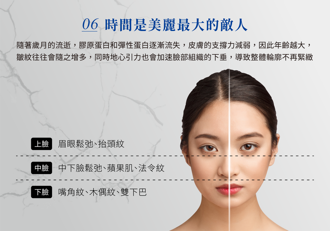 第四代拉提線 美塑線 圖片 7