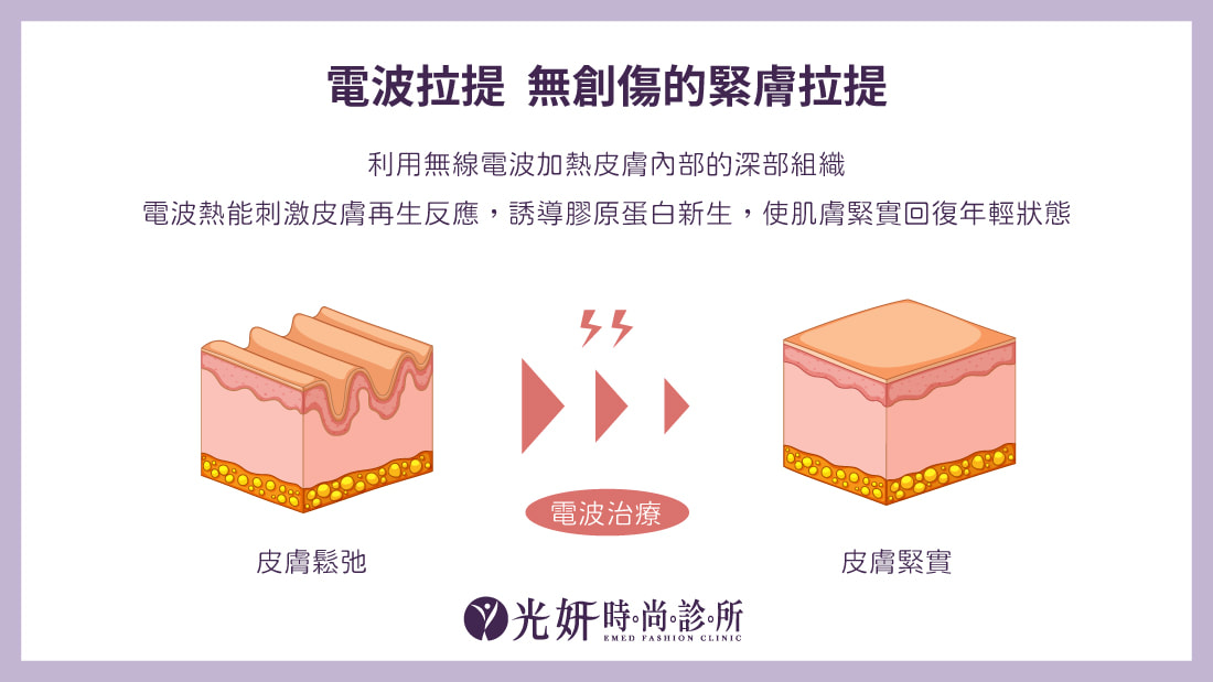 倍提電波 圖片 4