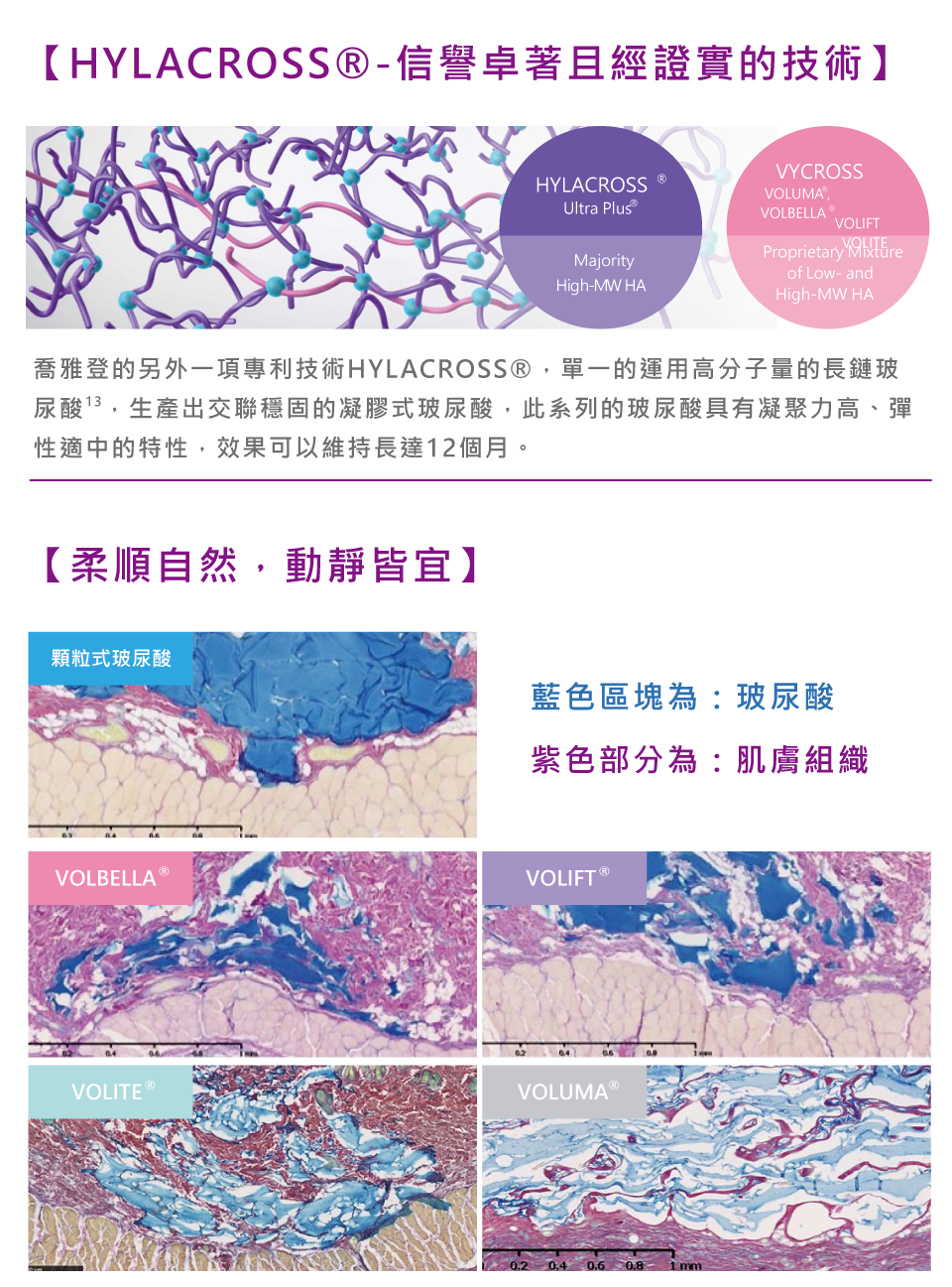 喬雅登玻尿酸 圖片 2
