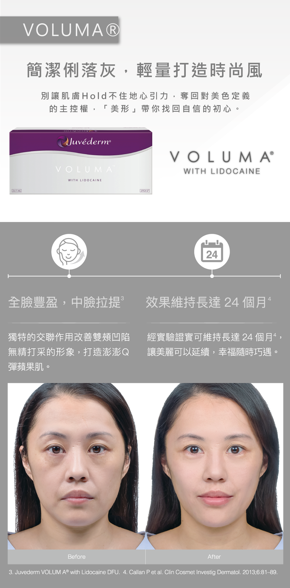 喬雅登玻尿酸 圖片 4