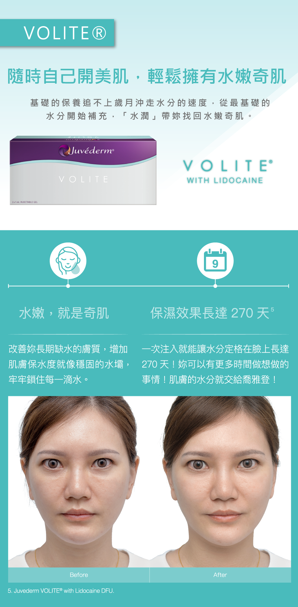 喬雅登玻尿酸 圖片 5