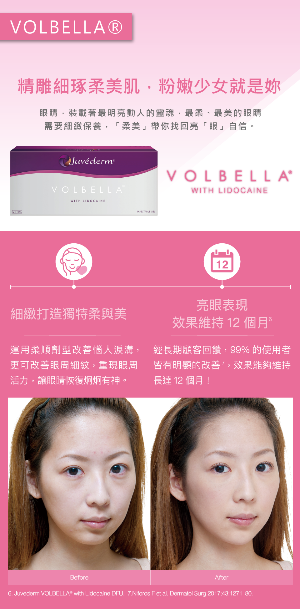 喬雅登玻尿酸 圖片 6