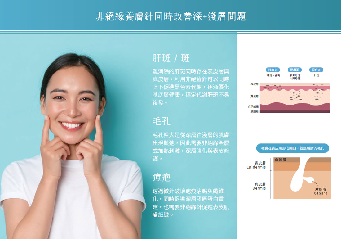 神比微針電波 圖片 6
