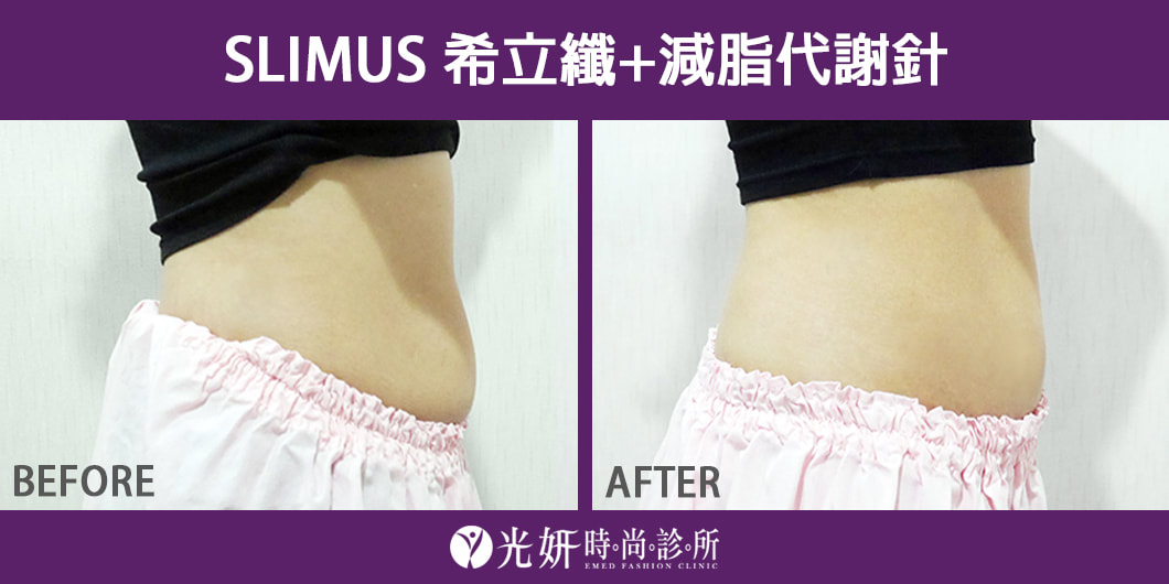 SLIMUS希立纖+減脂代謝針 圖片 1