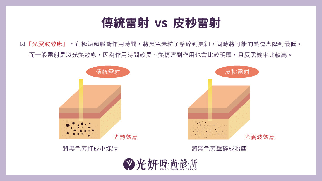 4D皮秒雷射 圖片 5